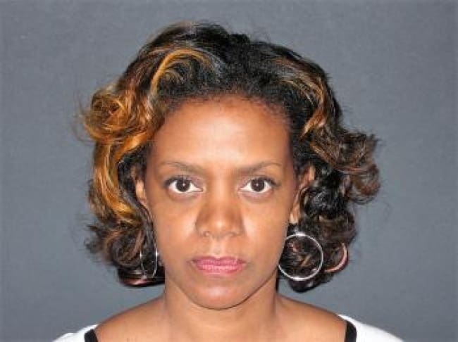 Rhinoplasty Before and After - Case 6, Image 2 - Female, age 35 – 44 - New York, NY - Dr. Vitolo Plastic Surgery